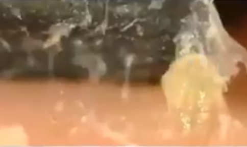 鼻の角栓以外にも顔全体の角栓をにゅるっと取るすごい動画